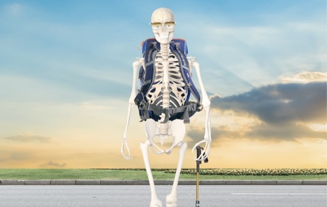 Osteoarthritis