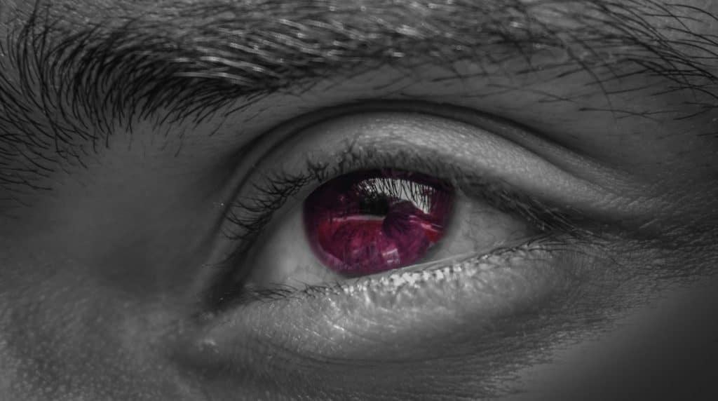 Dry Eye