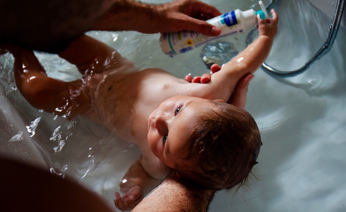 Eczema